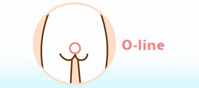 Oライン