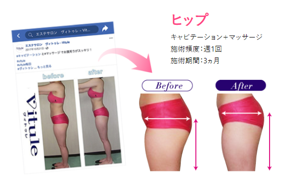 ダイエット 短期集中 5キロ 2週間ダイエットとは Jgs ダイエット 短期集中 5キロ 2週間ダイエットとは Jgs